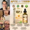 TOOYES® Natural GIP/GLP-1 Drops